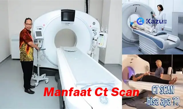 Manfaat CT Scan yang Jarang Diketahui, Anda Perlu Tahu!