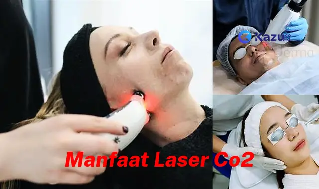 Temukan 7 Manfaat Laser CO2 yang Jarang Diketahui